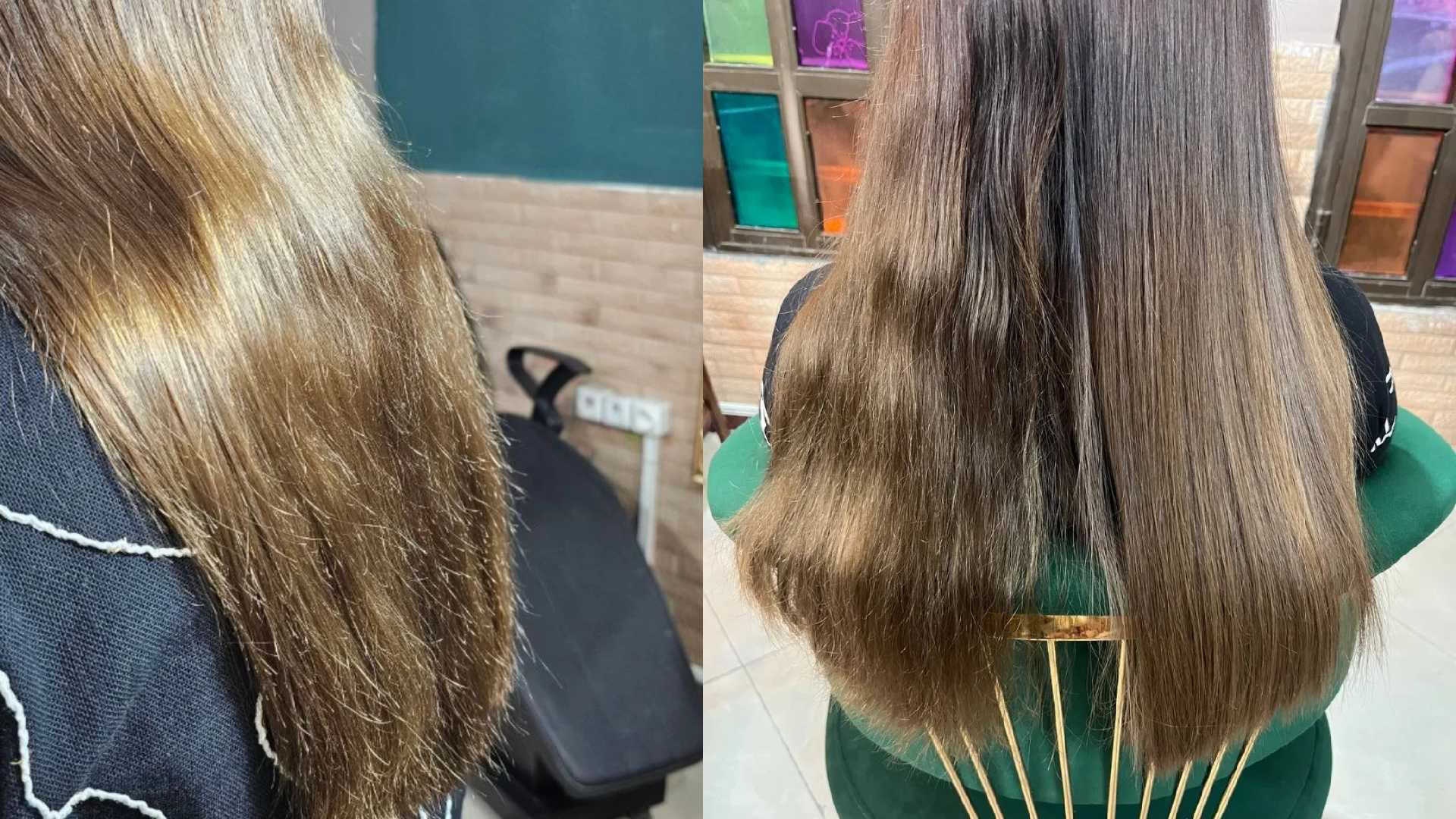 درمان موخوره در بابل؛ راهکار تخصصی در سالن الهام نعمتپور